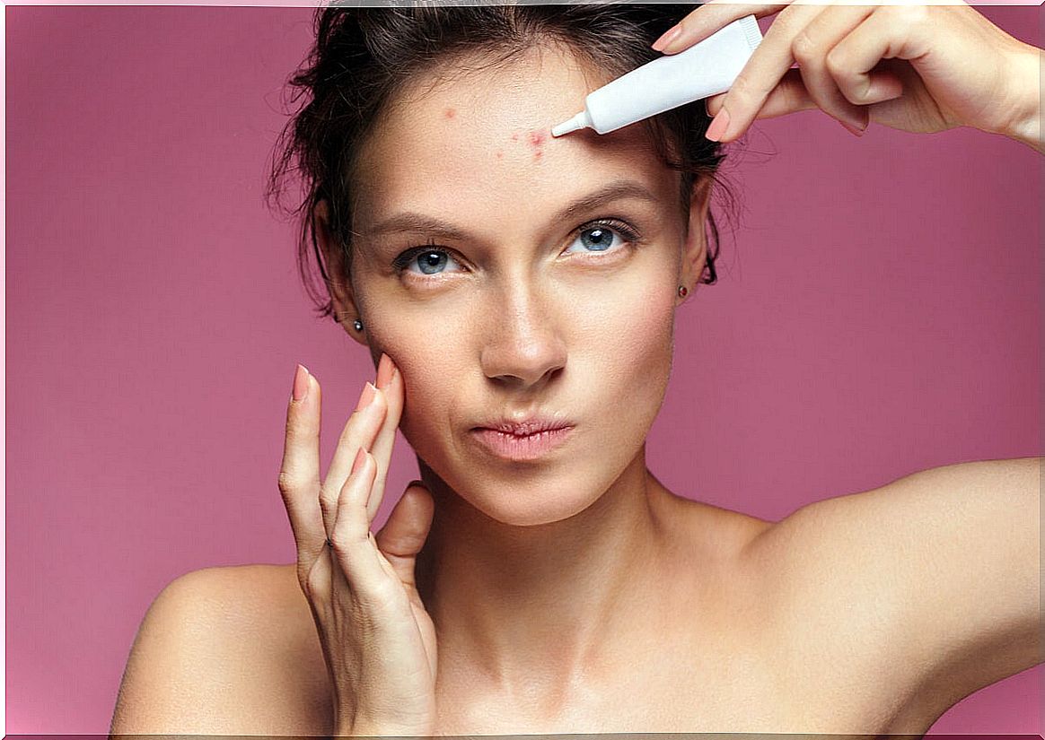 Woman treating acne.