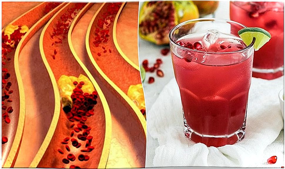 Pomegranate and aloe vera remedy to clean the arteries