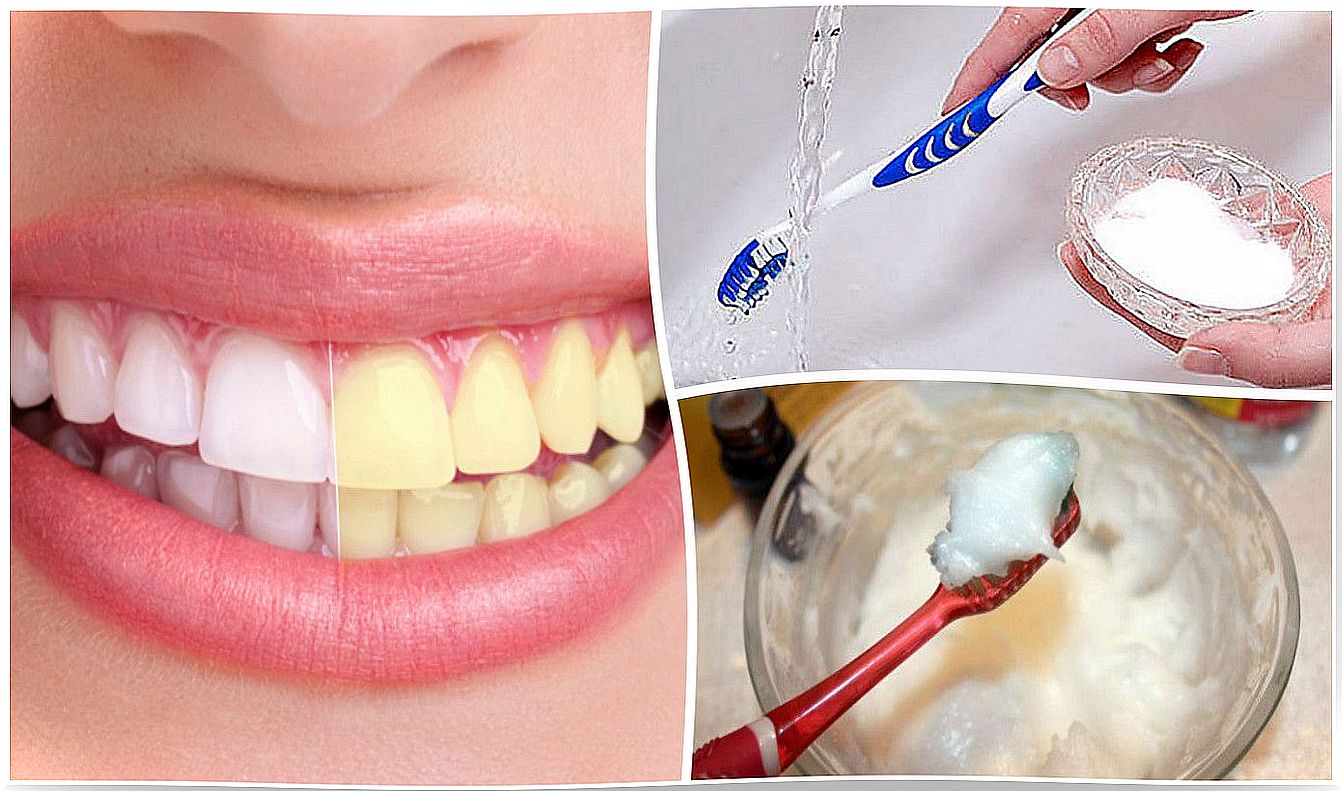 Whiten your teeth: 6 tricks with baking soda